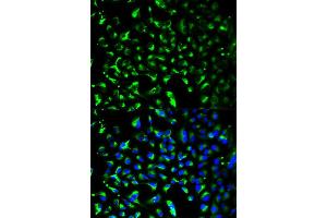 Immunofluorescence analysis of HeLa cell using PHB antibody. (Prohibitin Antikörper)