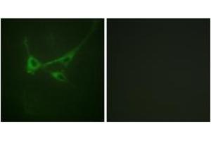 Immunofluorescence analysis of NIH-3T3 cells, using mTOR (Phospho-Ser2481) Antibody. (MTOR Antikörper  (pSer2481))