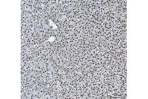 IHC analysis of HNRNPL using anti-HNRNPL antibody (ABIN4886624). (HNRNPL Antikörper  (C-Term))