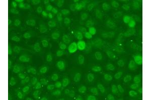 Immunofluorescence analysis of A549 cells using SSNA1 antibody. (SSNA1 Antikörper)