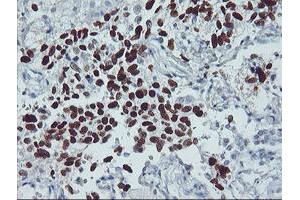 Immunohistochemistry (IHC) image for anti-Tumor Protein P53 (TP53) antibody (ABIN1499973) (p53 Antikörper)