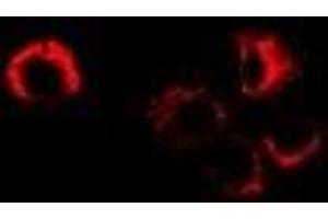 Immunofluorescent analysis of Sorbitol Dehydrogenase staining in MCF7 cells. (SORD Antikörper)