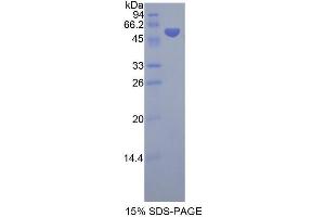 SDS-PAGE (SDS) image for Sphingomyelin phosphodiesterase 2, Neutral Membrane (Neutral Sphingomyelinase) (SMPD2) (AA 2-236) protein (His tag,GST tag) (ABIN2123392)