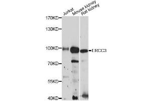 Western blot analysis of extracts of various cell lines, using ERCC3 antibody (ABIN6290288) at 1:3000 dilution. (ERCC3 Antikörper)