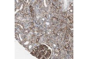 Immunohistochemical staining of human kidney with TCTA polyclonal antibody  shows cytoplasmic positivity in cells in tubules and glomeruli.