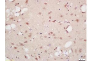 Formalin-fixed and paraffin embedded rat brain labeled with Rabbit Anti-B-Raf (Ser446) Polyclonal Antibody, Unconjugated (ABIN756787) at 1:200 followed by conjugation to the secondary antibody and DAB staining (SNRPE Antikörper  (pSer446))