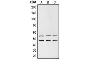 Western blot analysis of GSK3 alpha/beta expression in HEK293T (A), mouse liver (B), PC12 (C) whole cell lysates. (GSK3 alpha/beta Antikörper  (Center))