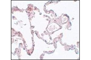 Immunohistochemistry of PLEKHM1 in human lung tissue with this product at 5 μg/ml. (PLEKHM1 Antikörper  (N-Term))