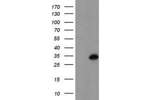 Western Blotting (WB) image for anti-Myeloid Leukemia Factor 1 (MLF1) antibody (ABIN1499495) (MLF1 Antikörper)
