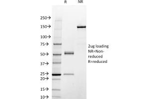 SDS-PAGE Analysis Purified STAT3 Mouse Monoclonal Antibody (STAT3/2409). (STAT3 Antikörper)