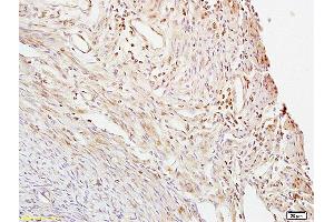 Formalin-fixed and paraffin embedded mouse uterus labeled with Anti- CTBP1 Polyclonal Antibody, Unconjugated (ABIN686152) at 1:200 followed by conjugation to the secondary antibody and DAB staining. (CTBP1 Antikörper  (AA 351-440))