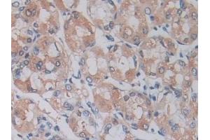 Immunohistochemistry (IHC) image for anti-ADAM Metallopeptidase Domain 17 (ADAM17) (AA 226-473) antibody (ABIN7426310)