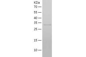 Arginase, Type II (ARG2) (AA 23-354) protein (His-IF2DI Tag)