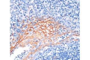 Immunohistochemistry of paraffin-embedded Human tonsil using AREG Polyclonal Antibody at dilution of 1:100 (40x lens). (Amphiregulin Antikörper)