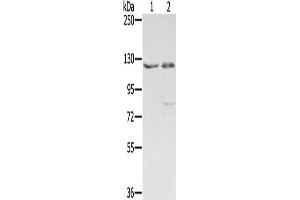 Gel: 6 % SDS-PAGE, Lysate: 40 μg, Lane 1-2: 293T cells, hela cells, Primary antibody: ABIN7192565(SMC6 Antibody) at dilution 1/400, Secondary antibody: Goat anti rabbit IgG at 1/8000 dilution, Exposure time: 1 minute (SMC6 Antikörper)