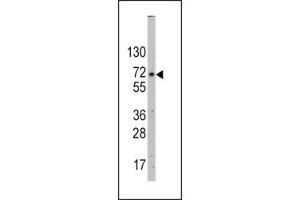 Western blot analysis of GLUT2 antibody and HepG2 lysate. (SLC2A2 Antikörper  (AA 31-60))