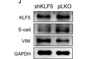 Western Blotting (WB) image for anti-Cadherin 1, Type 1, E-Cadherin (Epithelial) (CDH1) (AA 700-800) antibody (ABIN6138279)