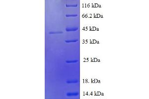 SDS-PAGE (SDS) image for Growth Differentiation Factor 9 (GDF9) (AA 320-454) protein (GST tag) (ABIN5709565) (GDF9 Protein (AA 320-454) (GST tag))