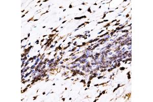 IHC analysis of EVL using anti-EVL antibody (ABIN7600986). (EVL Antikörper  (AA 268-400))