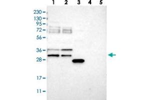 Western blot analysis of Lane 1: RT-4, Lane 2: U-251 MG, Lane 3: Human Plasma, Lane 4: Liver, Lane 5: Tonsil with RBM7 polyclonal antibody  at 1:250-1:500 dilution. (RBM7 Antikörper)