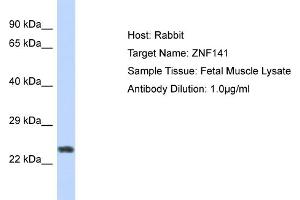 Host: Rabbit Target Name: ZNF732 Sample Tissue: Human Fetal Muscle Antibody Dilution: 1ug/ml (ZNF141 Antikörper  (N-Term))