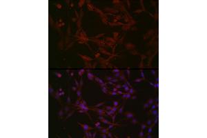 Immunofluorescence (IF) image for anti-Nephronophthisis 1 (Juvenile) (NPHP1) (AA 345-614) antibody (ABIN6144768)