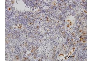 Immunoperoxidase of monoclonal antibody to FGR on formalin-fixed paraffin-embedded human lymph node. (Fgr Antikörper  (AA 1-90))