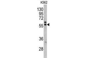 Western blot analysis of MAPE antibody (C-term) in K562 cell line lysates (35ug/lane). (PRAME Antikörper  (C-Term))
