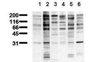Western Blotting (WB) image for anti-Phosphotyrosine antibody (ABIN126879) (Phosphotyrosine Antikörper)
