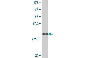 Western Blot detection against Immunogen (37. (CTBP2 Antikörper  (AA 138-239))