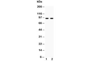 Western blot testing of Cadherin 17 antibody and Lane 1:  HeLa (LI Cadherin Antikörper  (AA 686-699))