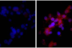 Human hepatocellular carcinoma cell line Hep G2 was stained with Rabbit IgG-UNLB isotype control, and DAPI. (TNFRSF10B Antikörper)