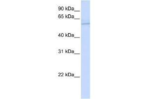 WB Suggested Anti-ND5 Antibody Titration:  0.