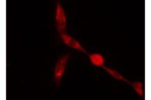 ABIN6274261 staining A549 cells by IF/ICC. (ZFP36L2 Antikörper  (Internal Region))