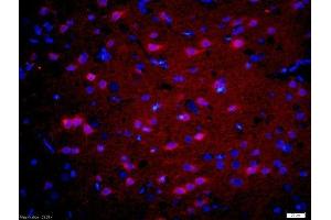 Immunofluorescence (IF) image for anti-Gonadotropin-Releasing Hormone Receptor (GNRHR) (AA 201-328) antibody (ABIN686917)