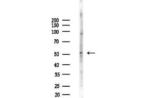 Western blot analysis of lysates from F10-LUC cells(starvation,24h treatment), using CLK4 Antibody at 1/1000 dilution.