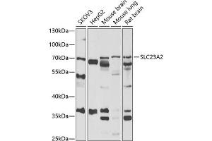 Western blot analysis of extracts of various cell lines, using SLC23 antibody (ABIN6133021, ABIN6147898, ABIN6147899 and ABIN6222467) at 1:1000 dilution. (SLC23A2 Antikörper  (AA 1-90))