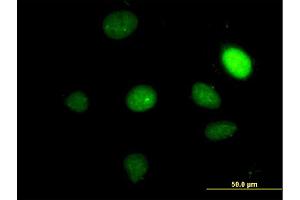 Immunofluorescence of monoclonal antibody to TBX2 on HeLa cell. (TBX2 Antikörper  (AA 603-702))