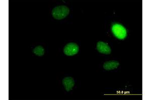 Immunofluorescence of monoclonal antibody to TBX2 on HeLa cell. (TBX2 Antikörper  (AA 603-702))