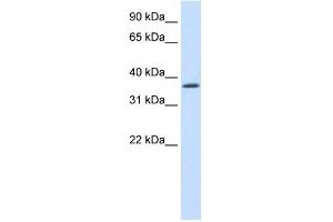 WB Suggested Anti-SAP30BP Antibody Titration:  1. (SAP30BP Antikörper  (C-Term))