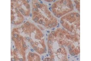 Used in DAB staining on fromalin fixed paraffin- embedded Kidney tissue (SPRED2 Antikörper  (AA 1-418))