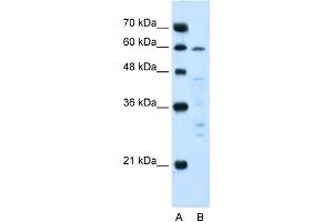 WB Suggested Anti-IL10RA Antibody Titration:  5. (IL-10RA Antikörper  (N-Term))