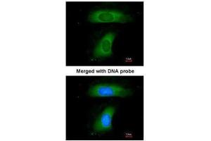 ICC/IF Image Immunofluorescence analysis of paraformaldehyde-fixed HeLa, using B-cell linker protein, antibody at 1:200 dilution. (B-Cell Linker Antikörper  (C-Term))