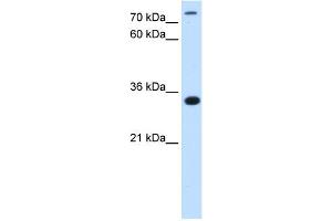 WB Suggested Antibody Titration:  2. (TAM41 Antikörper  (N-Term))