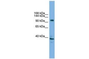 Image no. 1 for anti-ATPase, H+ Transporting, Lysosomal V0 Subunit A1 (ATP6V0A1) (AA 671-720) antibody (ABIN6744589) (ATP6V0A1 Antikörper  (AA 671-720))
