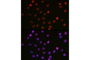 Immunofluorescence analysis of C6 cells using [KO Validated] Acetyl-HMGB1-K29 Rabbit pAb (ABIN7267647) at dilution of 1:100 (40x lens). (HMGB1 Antikörper  (acLys29))