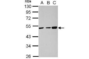 WB Image Sample (30 ug of whole cell lysate) A: 293T B: HeLa C: HepG2 10% SDS PAGE antibody diluted at 1:1000 (TXNDC5 Antikörper)