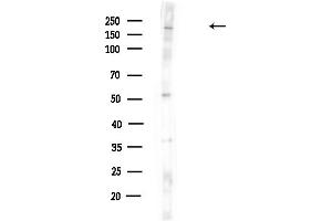 anti-Suppressor of Ty 6 Homolog (SUPT6H) (C-Term) antibody