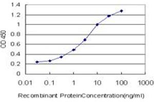 Detection limit for recombinant GST tagged UMPS is approximately 0. (UMPS Antikörper  (AA 381-479))