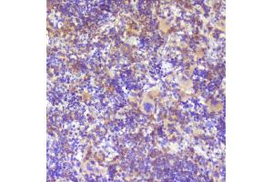 IHC analysis of RP2 using anti-RP2 antibody (ABIN6719513). (RP2 Antikörper  (AA 244-348))